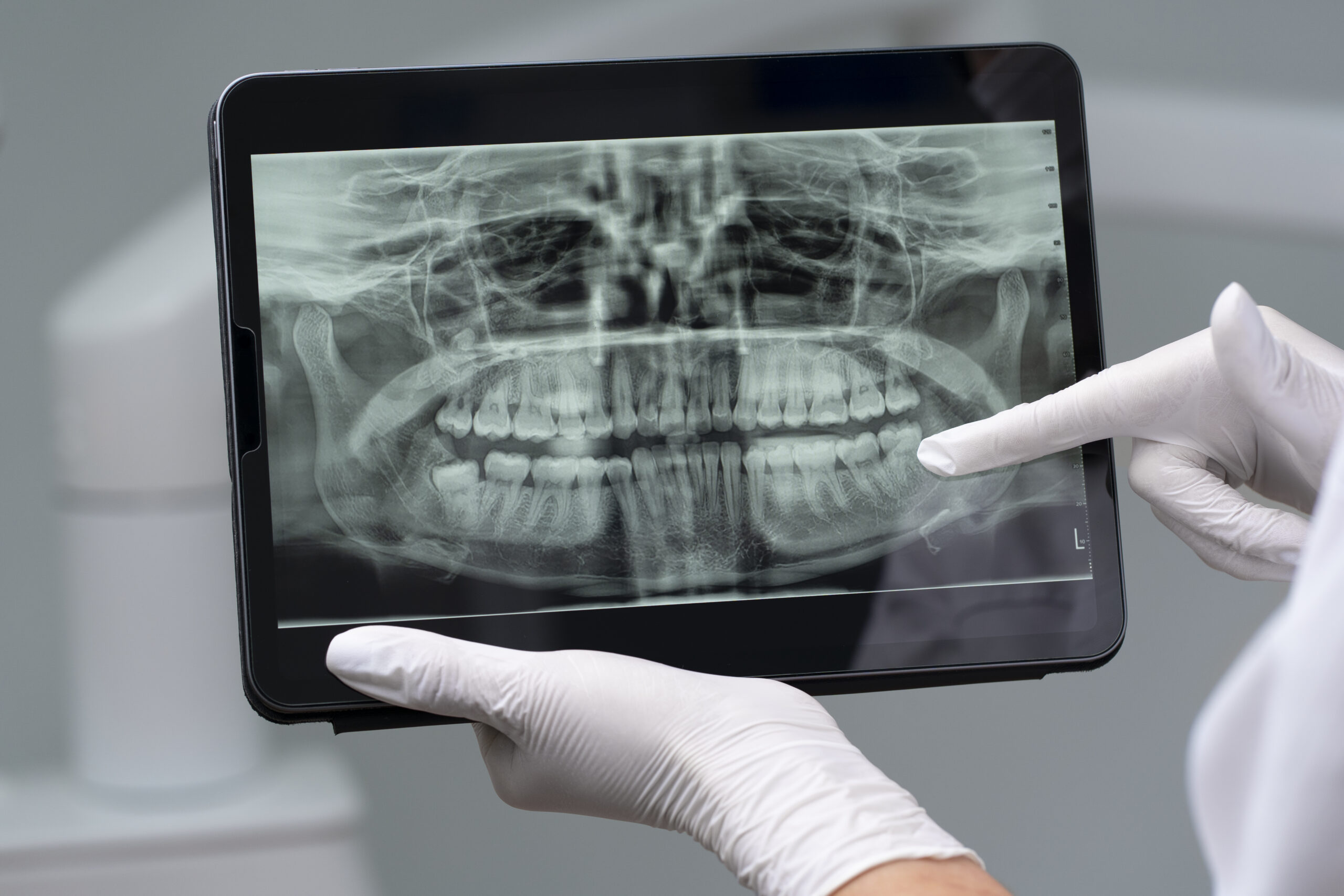 proximo-plano-dos-instrumentos-dentarios